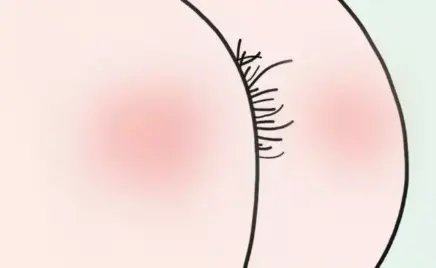 人为什么会长肛毛？能剃掉吗