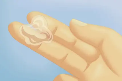 为什么女生内裤总是湿湿的