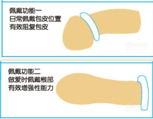 锁精环带在哪里，锁精环怎么戴