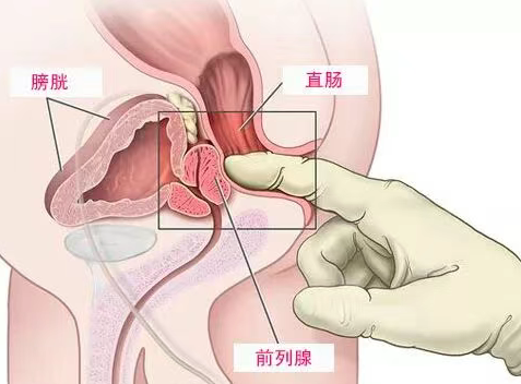 新手怎样才能快速触发前高的快乐感