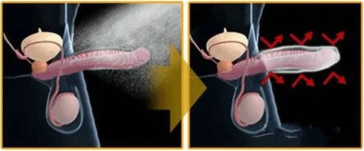撑不到 3 分钟就「投降」，早泄还有救吗？
